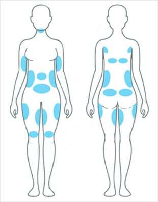 COOLSCULPTING – Eureka Body Care & Spa